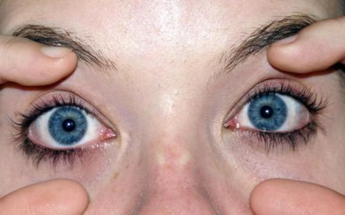 Что делать если скрипит. Причины скрипа 03