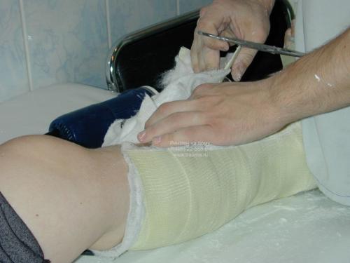 Как гипс растворить. Гипсовые растворы: состав, пропорции, приготовление, применение 06 Как гипс растворить. Гипсовые растворы: состав, пропорции, приготовление, применение 06