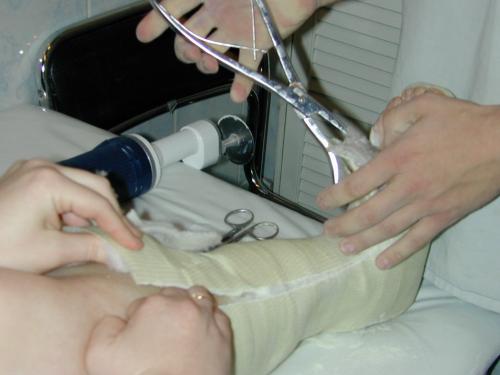 Как гипс растворить. Гипсовые растворы: состав, пропорции, приготовление, применение 09 Как гипс растворить. Гипсовые растворы: состав, пропорции, приготовление, применение 09