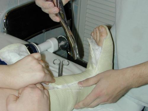 Как гипс растворить. Гипсовые растворы: состав, пропорции, приготовление, применение 08 Как гипс растворить. Гипсовые растворы: состав, пропорции, приготовление, применение 08